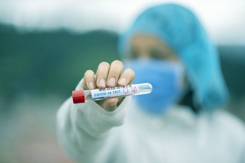 test antigen